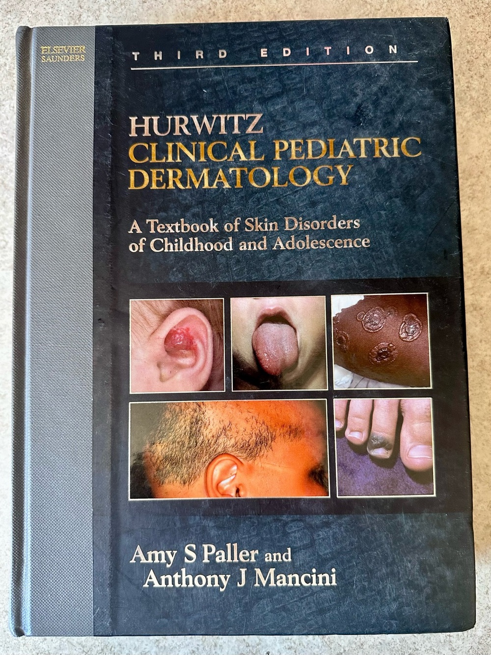 Hurwitz Clinical Pediatric Dermatology - Hard Cover